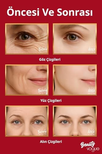 Boyun Yüz Sıkılaştırıcı Kırışıklık Giderme Aleti, Çift Çene Azaltıcı Titreşim Masajı Kırışıklıklar Görünüm Giderme ve Yüz için Cilt Sıkılaştırma, Boyun