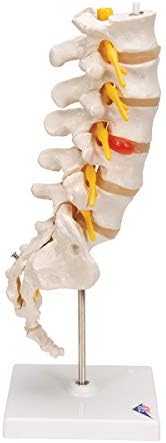 Alternative view of 3B Scientific A76/5 Bel Omurga Sütunu, Dorso-Lateral Prolapsed Intervertebral Disk, 34 cm Yükseklik