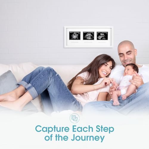 Alternative view of 87038 Trimester Sonogram Frame Deluxe, fotoğraf çerçevesi için üç Ultraschallaufnahmen, beyaz
