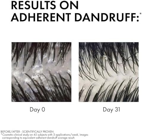 VICHY Dercos Anti Dandruff Kuru Saçlar İçin Kepek Karşıtı Şampuan 200 ml
