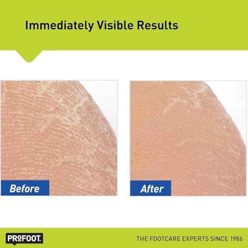 Alternative view of Profoot Argan Yağlı Kokusuz Nemlendirici Ayak Kremi 454GR