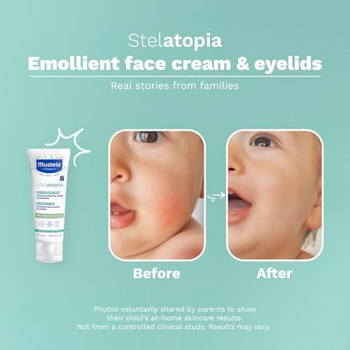 Stelatopia Emollient Yüz Kremi (40ml)