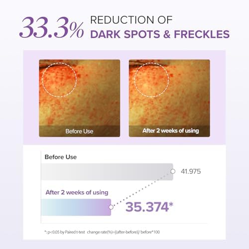 Alternative view of Mary&May Tranexamic Acid+glutathion Aydınlatıcı Göz Çevresi Kremi 30 Gr