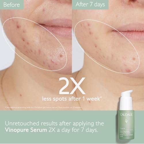 Caudalie Vinopure Blemish Control Salicilic Serum - 30Ml