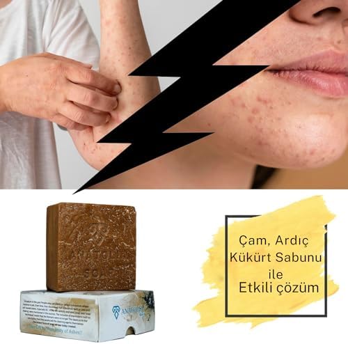 Soap 1978 Antioch Koleksiyonu Çam Ardıç Kükürt Doğal Özel Üretim Egzama Sivilce 1 Kalıbı 130 gr. Tekli Paket
