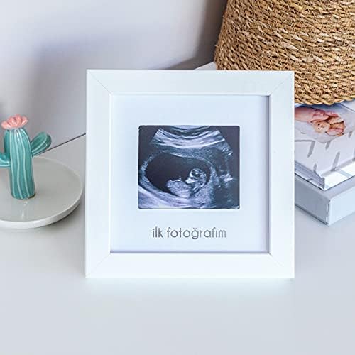 İlk Fotoğrafım Bebek Ultrason Çerçevesi - Bebek Odası Resim Anı Çerçevesi