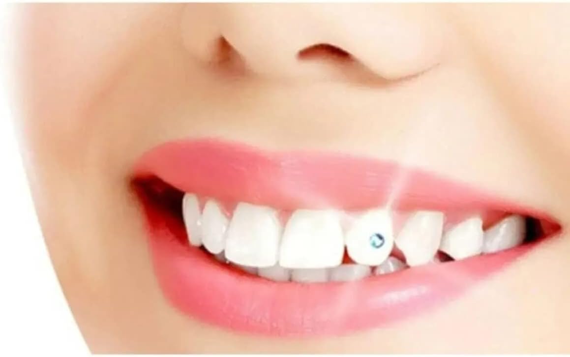 5 Adet Kristal Diş Taşlı Diş Pırlantası Seti