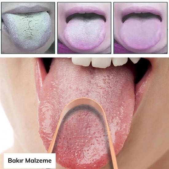 Alternative view of Outlet Bakır Oil Pulling Yağ Çekme Dil Plak Temizleme Aleti Dil Fırçası Sıyırıcı Dil Kaşığı