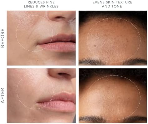 Alternative view of FOREO derma