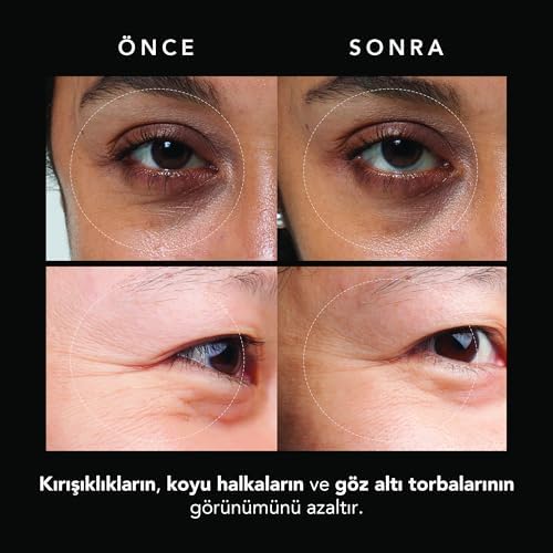 Alternative view of FAQ Mikroiğneli Kırışıklık Karşıtı Hyaluronik Asit Göz Altı Pedleri – Göz Altı Şişlikleri ve Morluklara Karşı Pedler – Anında Etki – Seyahat Dostu – 3x2 Adet