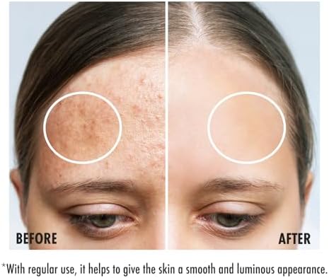Alternative view of Maruderm Glycolic Acid Tonik 250 ml