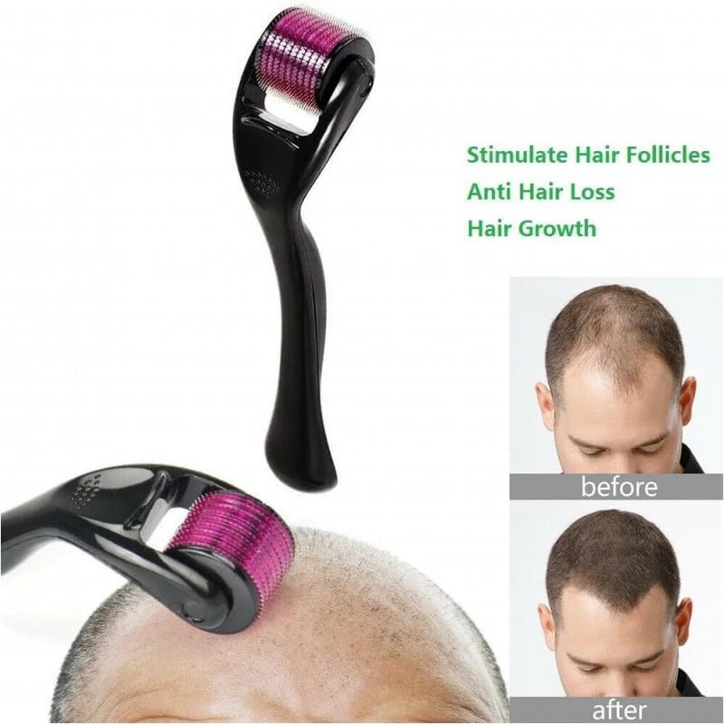 moddestore Dermaroller 0,5 mm 540 Titanyum İğne Cilt Bakımı, Yüz Kırışıklıkları İçin Saç Dökülmesi, Sakal Büyümesi, Saç Büyümesi, Mikro İğneler, Profesyonel Mikro İğneler (0,5MM)