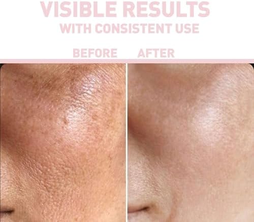 Nıacınamıde%10 + Hyaluronıc Acıd%2 Serum