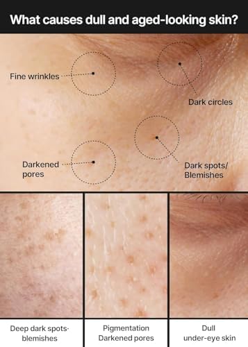 Alternative view of Celimax Pore+Dark Spot Brightening Cream 35ml / Leke Kremi