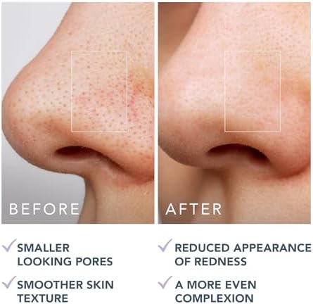 Alternative view of FOREO Gözenek Minimizing Toner Pedleri 60 adet – Witch Hazel & Centella Asiatica Peeling Yüz Pedleri, Yağ, Akne Taç Cilt için – Gözenek Minimizer ve Redness Rölyef