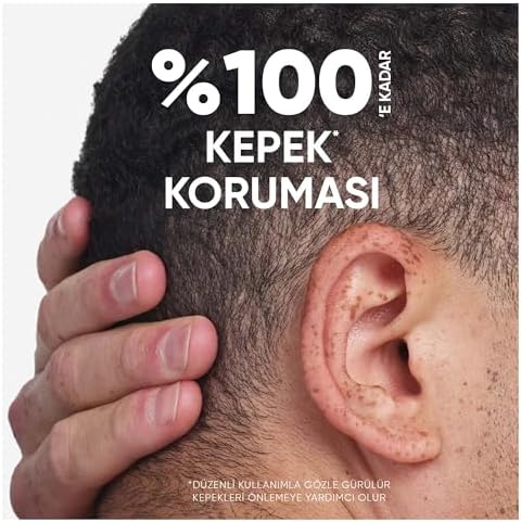 & Shoulders Limon Ferahlığı 2'si 1 Arada Yağlı Saçlar için Kepeğe Karşı Etkili Şampuan 300ml