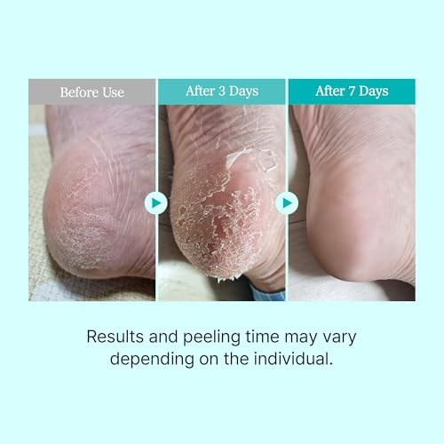 Alternative view of Ariul Smooth & Pure Foot Peeling Mask Purifying 2 pairs - Derinlemesine Arındırıcı Ayak Peeling Maskesi 2 çift
