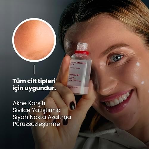 Akne Karşıtı Losyon 30 ml
