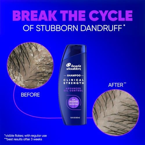 & Shoulders Clinical Strength Advanced Oil Control Kepek Karşıtı Şampuan 400ML
