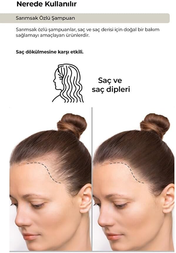 Alternative view of Zishu Sarımsak Özlü Şampuan Saç Dökülmesine Karşı 400 ml