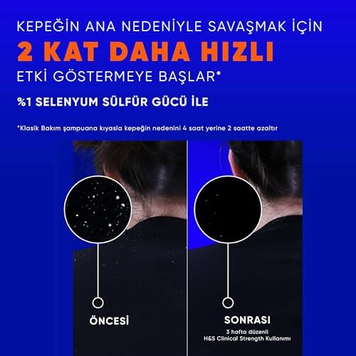 & Shoulders Clinical Strength Dry Scalp Rescue Kuru Saç Derisine Özel Şampuan 400 ml