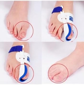 Ayak Baş Parmak Kemik Çıkıntı Düzeltici Hallugs Valgus 1 Çift
