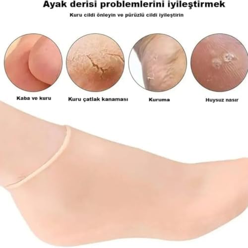 Alternative view of Nemlendirici Jel Topuk Çorabı - Çatlak Topuk Giderici ve Yumuşatıcı Spa Çorabı - Gece Bakımı İçin Açık Parmaklı Jel Çorap-Krem Sonrası Koruma