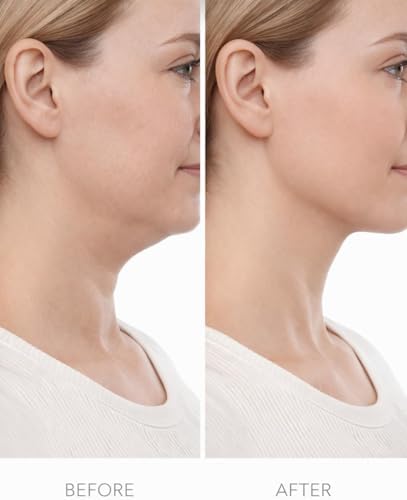 Lenf Drenaj Fırçası Yüz ve Vücut İçin Kuru Masaj Fırçası Selülit Azaltıcı Cilt Arındırıcı Lenfatik Akış Destekleyici Ergonomik Saplı Şekillendirici Masaj Aracı (İkili)