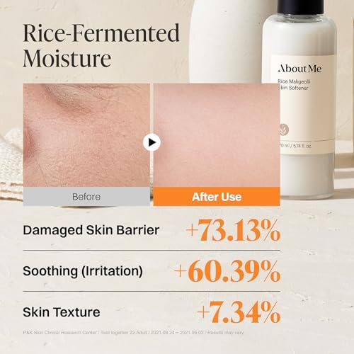 ABOUT ME Rice Makgeolli Skin Pirinç Mayası Özlü Fermentli Beyazlatıcı Aydınlatıcı Cilt Toniği 170 ml