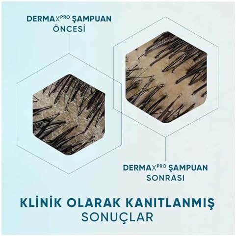 & Shoulders DermaXPro Yatıştırıcı Kepek Karşıtı Şampuan Kuru ve Kaşıntılı Saç Derisi için 300 ML