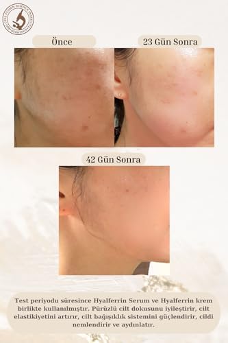 Alternative view of Biogen Sinyal Kremi | 50 ml | Yüz Kremi | Cilt Bariyeri Oluştucu Etki | Dünyanın İLK cilt için optimize edilmiş Laktoferrini