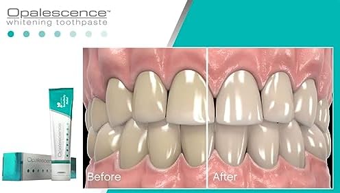 Alternative view of Opalescence Beyazlatıcı Sensitivity Relief Diş Macunu, 133gr