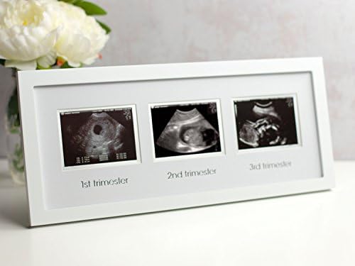 Alternative view of Pearhead 87038 Trimester Sonogram Frame Deluxe, fotoğraf çerçevesi için üç Ultraschallaufnahmen, beyaz