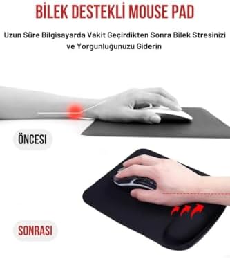 ErgoSoft Kare Bilek Destekli Konfor Kaymaz Ergonomik Mouse Pad Siyah Siyah